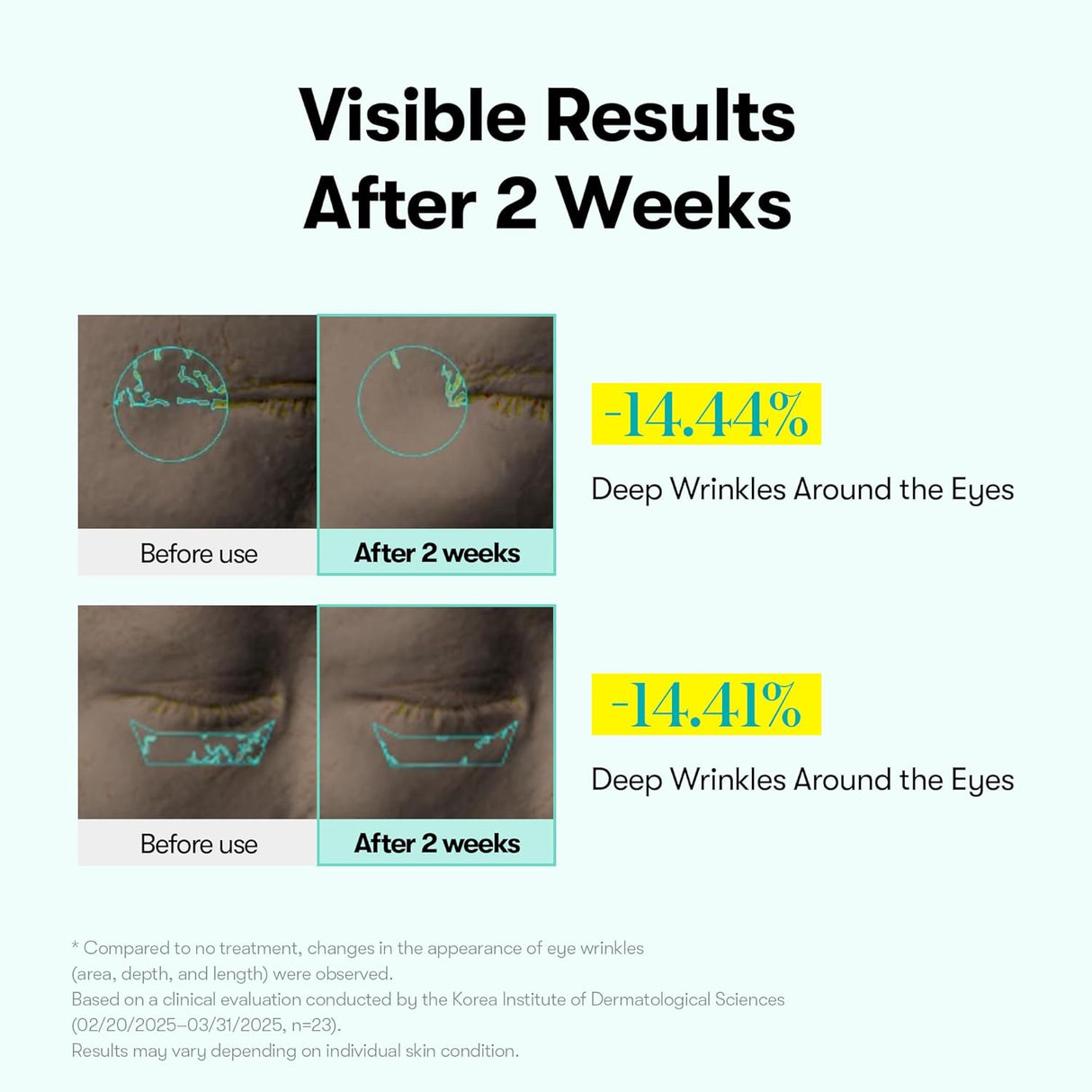 VT COSMETICS | PDRN Reedle Shot Eye Lifter - 15ml