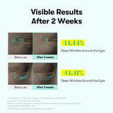 VT COSMETICS | PDRN Reedle Shot Eye Lifter - 15ml
