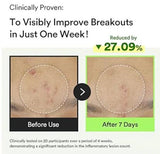 ABIB | Heartleaf TECA Capsule Serum - 50ml