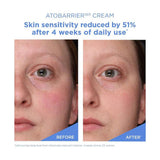AESTURA Atobarrier 365 Cream Mini - 30ml: resultados cosméticos y evaluación de uso, detalle complementario; hidratación y barrera cutánea