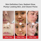 MEDICUBE | AGE- R Booster Pro - White