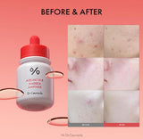 DR. CEURACLE | Azelaic 10 & Madeca Ampoule - 30ml