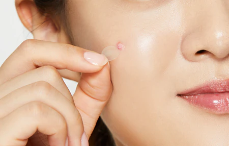 COSRX | Clear Fit Master Patch (18 ea)