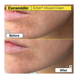 DR. JART+ | Ceramidin Ectoin-Infused Cream - 50ml