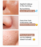 ELROEL | Pore Clearing Pack - 30ml