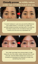 NINE LESS | Ever-Youth Dual Effect Eye Cream - 20 ml