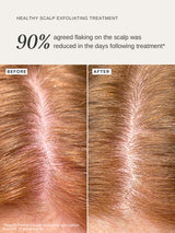ALPHA-H | Healthy Scalp Exfoliating Treatment - 100ml