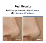 ISNTREE | Hyper Acid4 30 Serum AHA / BHA / PHA / LHA - 20ml