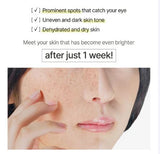 ANUA | Vitamin C Blemish Serum Mask - 1ud