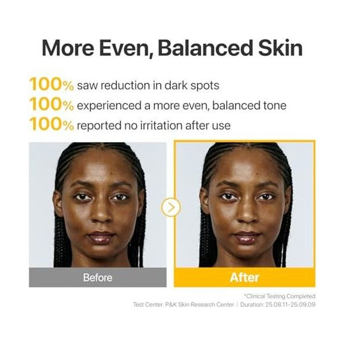 NUMBUZIN No.5 Glutathione TXA Advanced Dark Spot Ampoule Concentrate - 10gr: resultados cosméticos y evaluación de uso, detalle complementario; tratamiento concentrado para hidratación y luminosidad