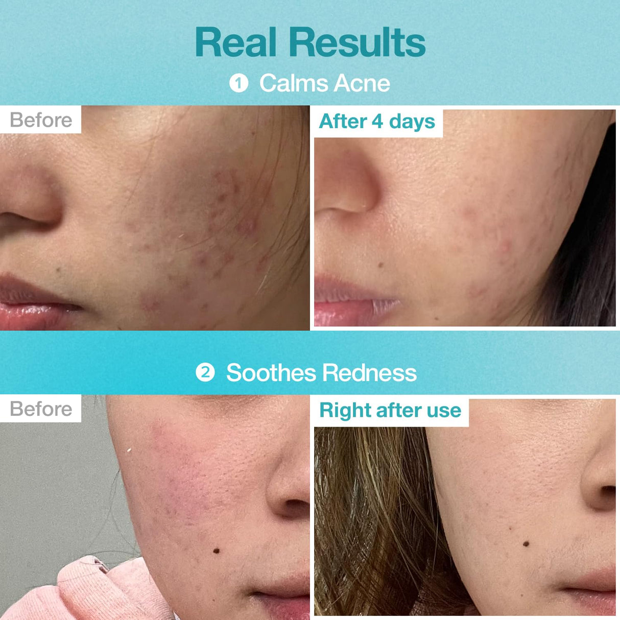 NUMBUZIN | No.1 Pantothenic B5 Hyaluronic Active Clear Mask