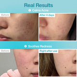 NUMBUZIN | No.1 Pantothenic B5 Hyaluronic Active Clear Mask