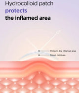 ISNTREE | Onion Newpair Spot Patch