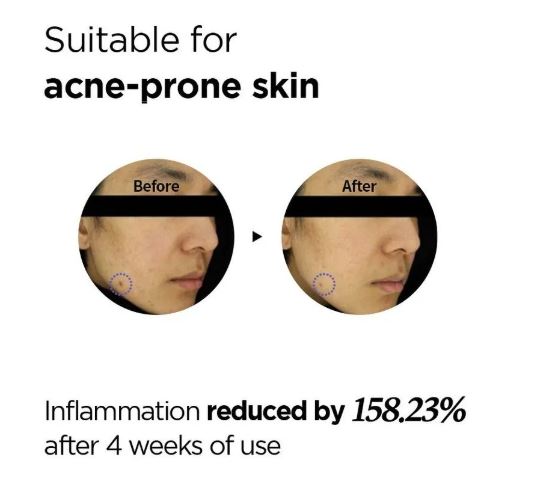 ISNTREE | Onion Newpair Spot Patch