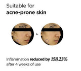 ISNTREE | Onion Newpair Spot Patch