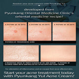 PYUNKANG YUL | ACNE Cream - 50ml