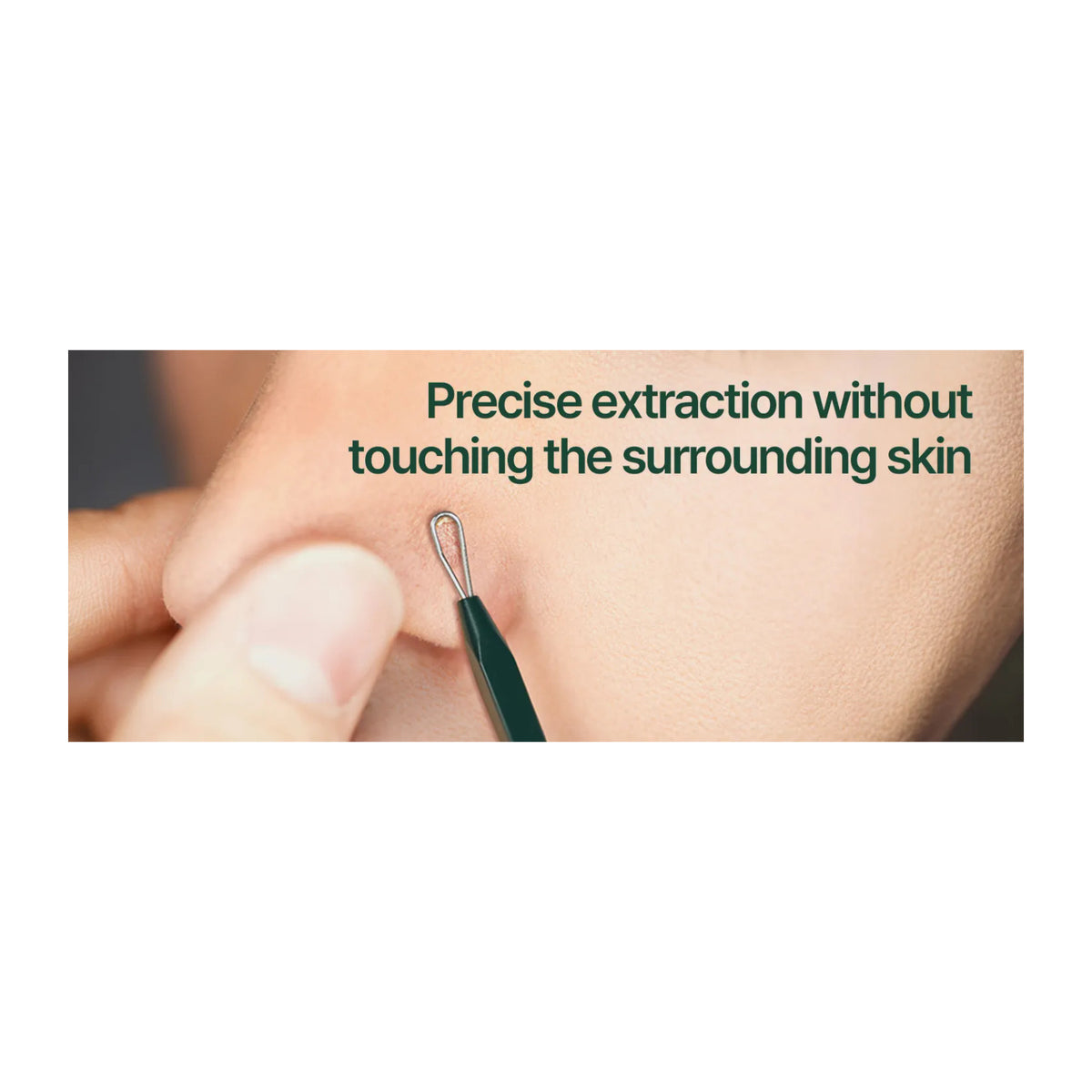 PYUNKANG YUL | Pimple Extractor