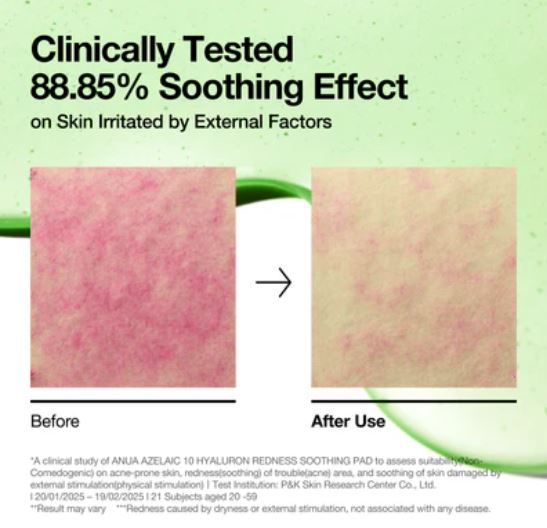 ANUA | Azelaic 10 Hyaluron Redness Soothing Pad - 90ml