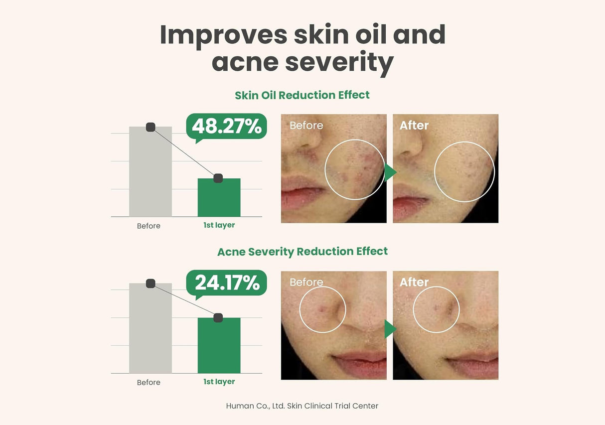 AXIS-Y | Spot The Difference Blemish Treatment - 15ml
