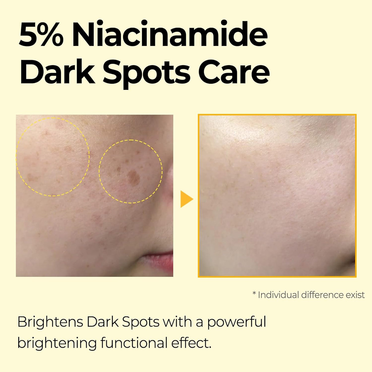 SOME BY MI | Yuja Niacin Dark Spot Correcting Stick - 10gr