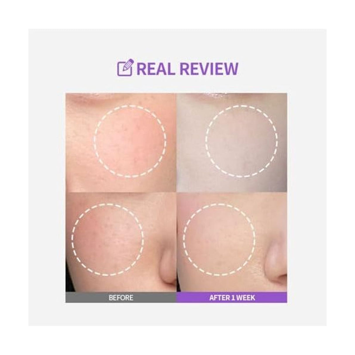 SUNGBOON EDITOR Meoru Podo VitaC Dark Spot Ampoule - 30ml: resultados cosméticos y evaluación de uso; protección solar y cuidado de la piel