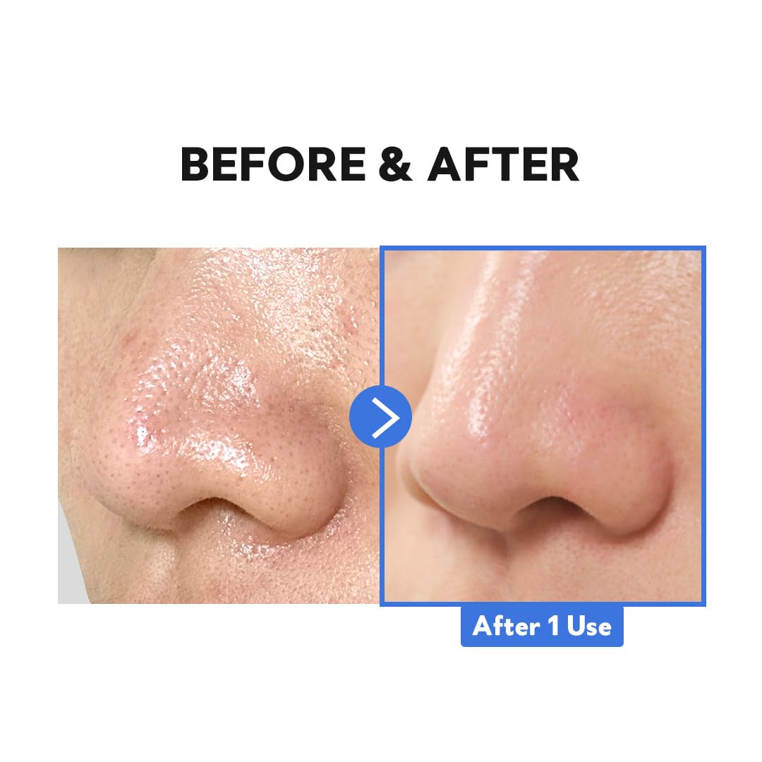 TIRTIR | Hydro Boost Enzyme Cleansing Balm