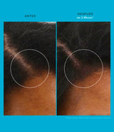 Scalp Care Revitalizing Treatment de Living Proof